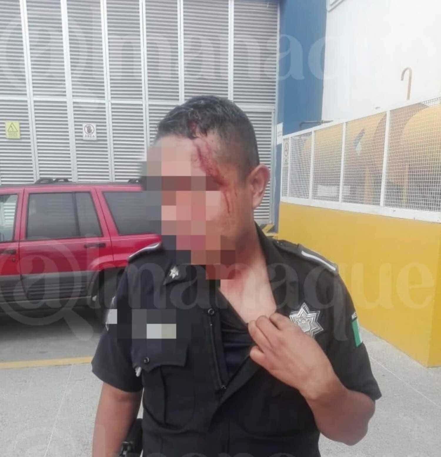 Policía es golpeado con un tubo al tratar de hacer una detención en Lomas de San Miguel 1 WhatsApp Image 2020 08 20 at 7.27.30 PM 4