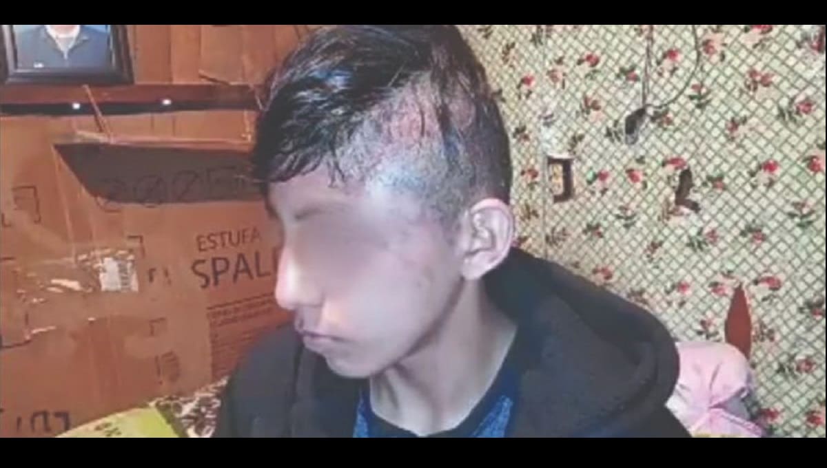 “Me rociaron gas pimienta y me golpearon en la patrulla”: Alan de 14 años, detenido por policías de Huauchinango 1 allan 1