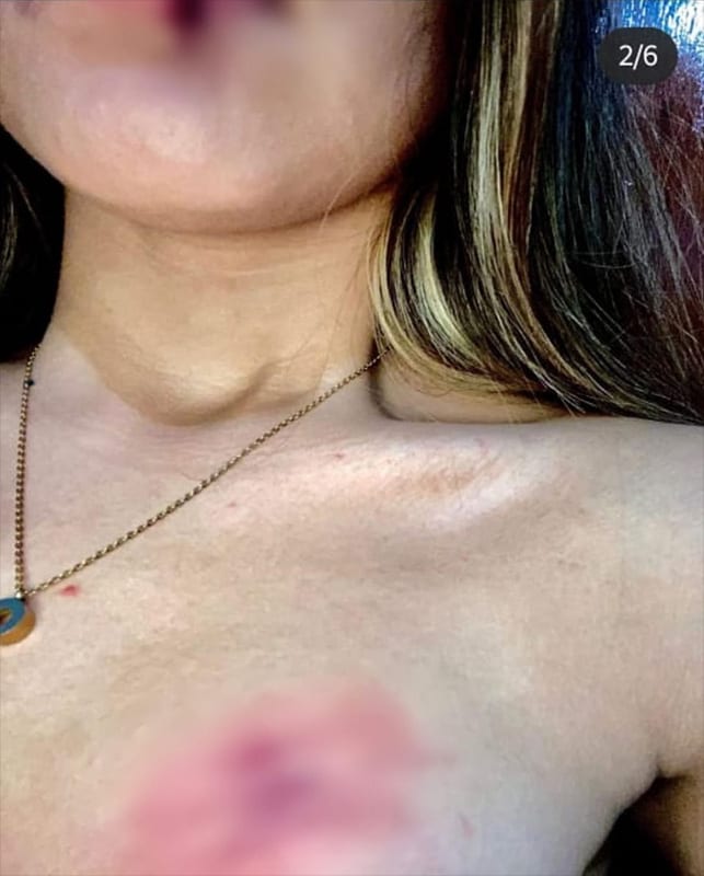 agresion a montserrat 2