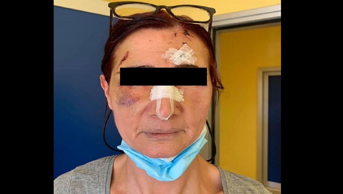 Mujer recibe brutal paliza por pedirle a un hombre que use cubrebocas 1 agresion por cubrebocas 1