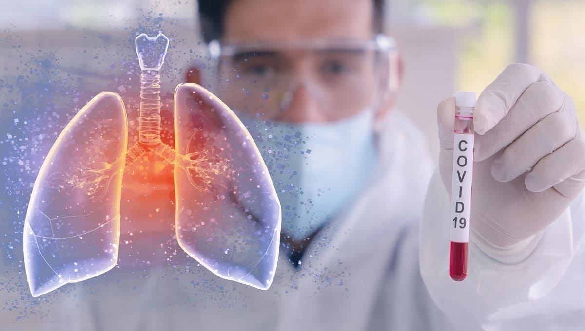 Desarrollan antídoto en forma de “yogur” que crea anticuerpos contra COVID-19 en Rusia 1 facts coronavirus covid 19 tec de monterrey 1