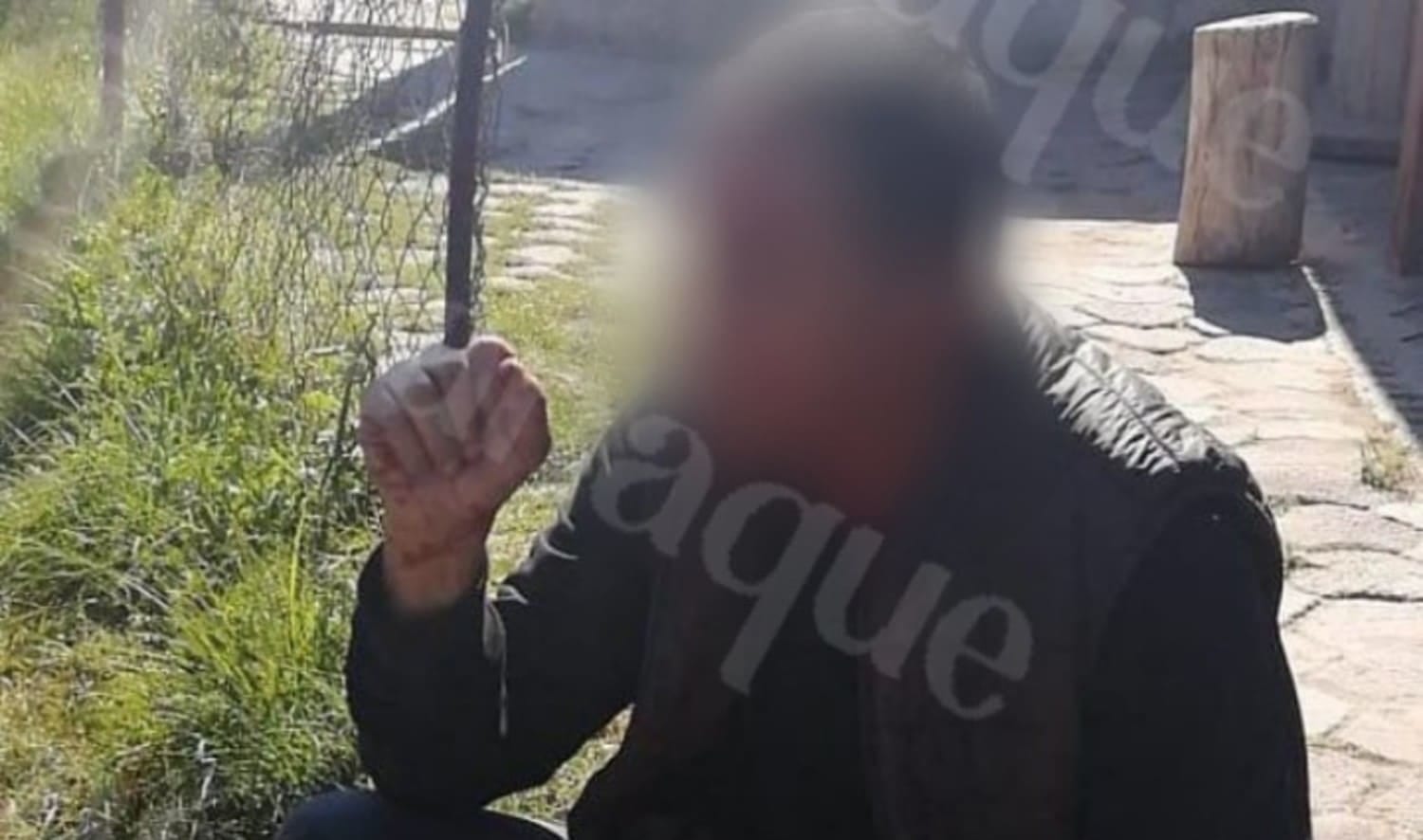 Disparan en la cara a un hombre para asaltarlo en Puebla 2 WhatsApp Image 2020 10 06 at 4.04.38 PM 2