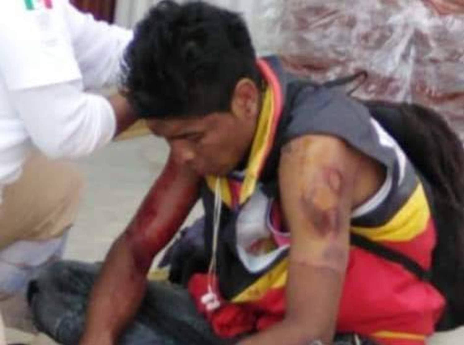 Dan golpiza a hombre acusado de ladrón en Atlixco 1 WhatsApp Image 2020 10 09 at 5.56.52 PM 2 1 1