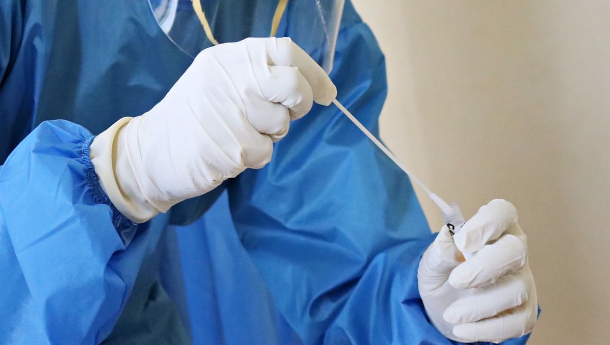 México acumula más de 924 mil casos de COVID-19 1 test covid 1
