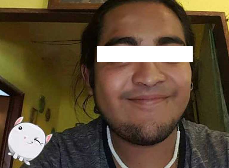 A la pequeña Victoria la atacaron dos Pitbull en Puebla; necesita ayuda para sus medicamentos 12 medicamentos5