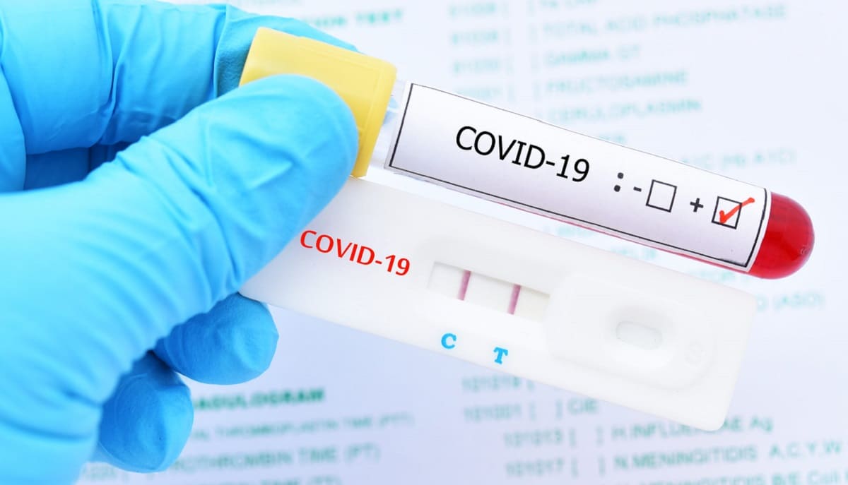 Reino Unido aprueba contagiar de COVID-19 a personas sanas para realizar estudios 2 prueba covid 1