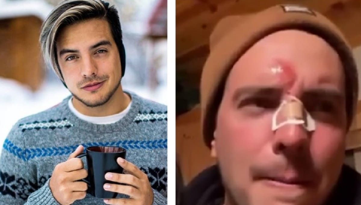 "Me fui de hocico": Vadhir Derbez sufre caída mientras esquiaba 2 vhadir 1
