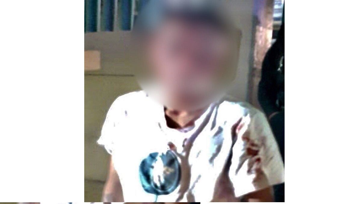 Usuarios del transporte público golpean a Brandon Bryan y lo dejan deforme en Iztapalapa 1 brondon