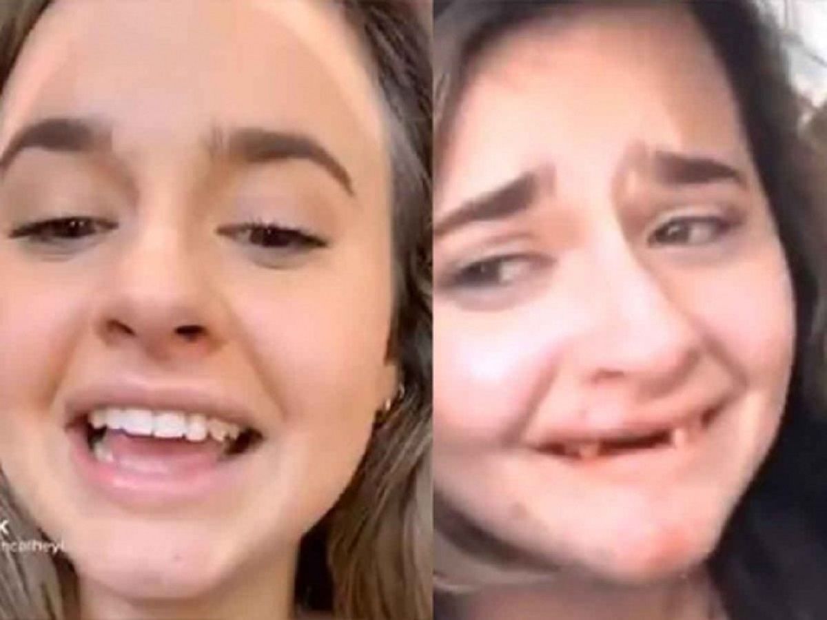 se grabo para video de Tik Tok y termina sin dientes