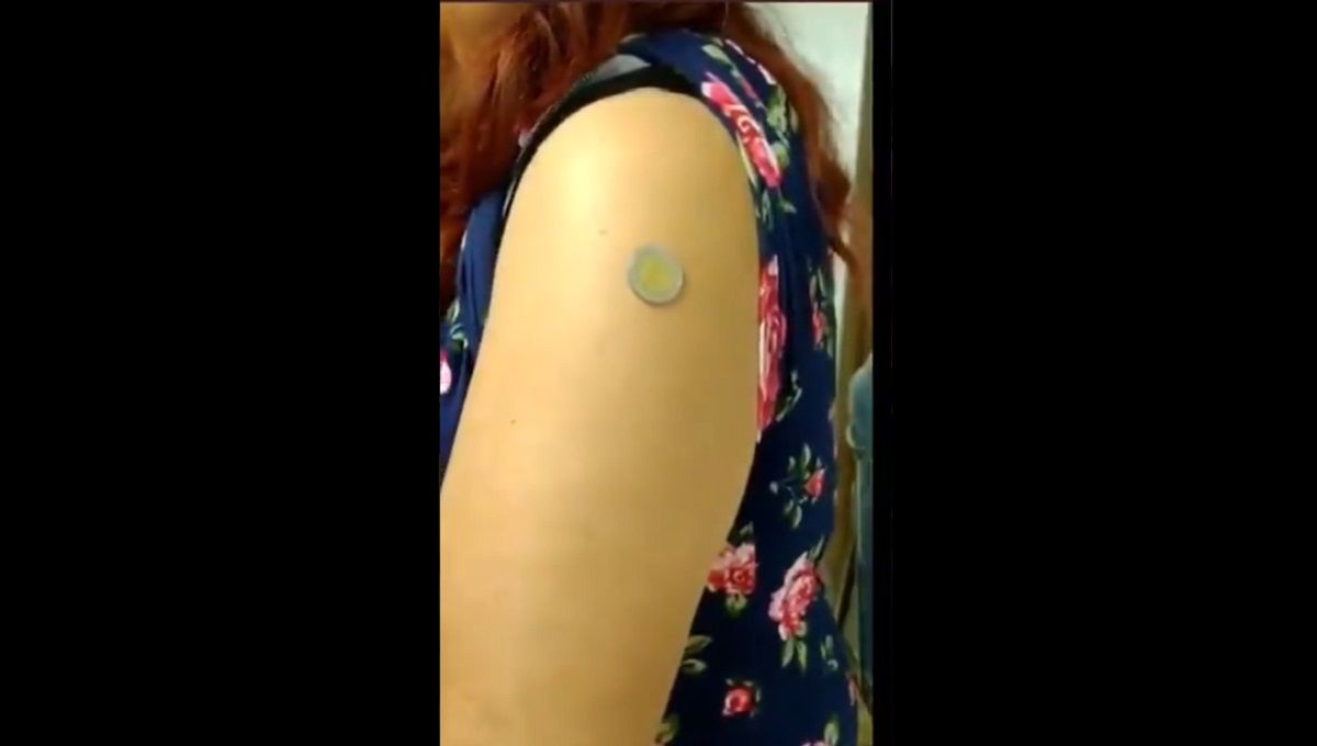 Poblanos aseguran que por vacunación antiCOVID tienen imantación en el brazo (VIDEOS) 2 imanes