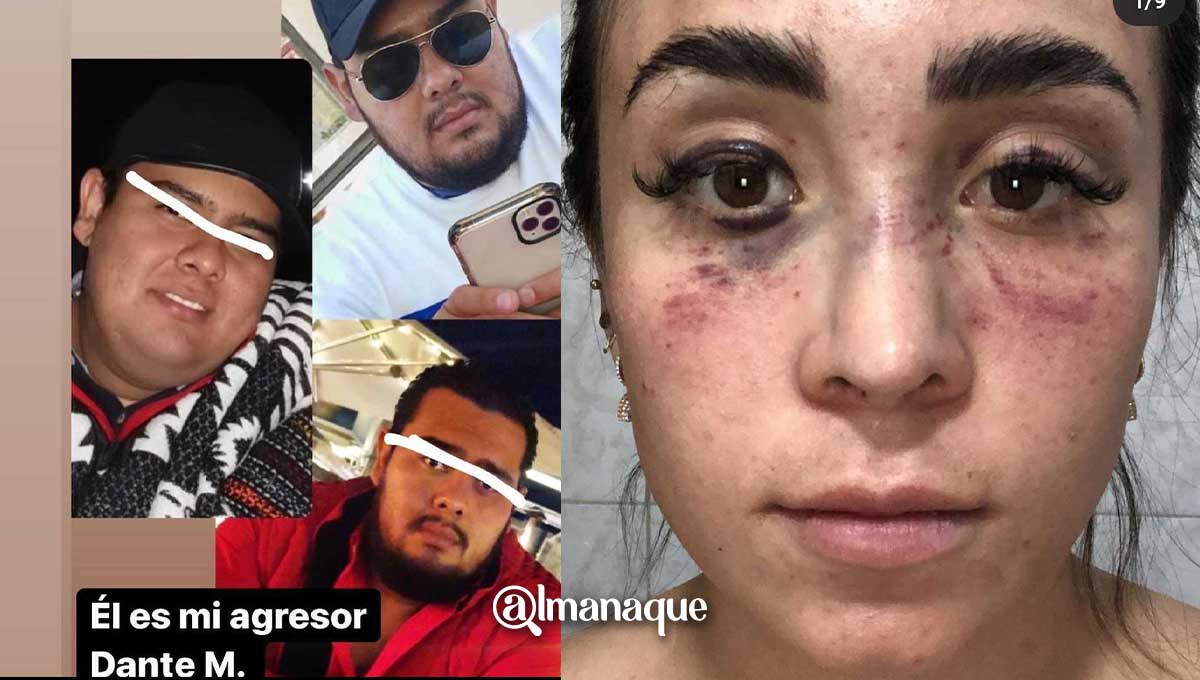 #JusticiaparaKenya Poblana embarazada fue golpeada por su novio y pide la intervención del gobernador 1 Kenya Mirelle Puebla embarazada