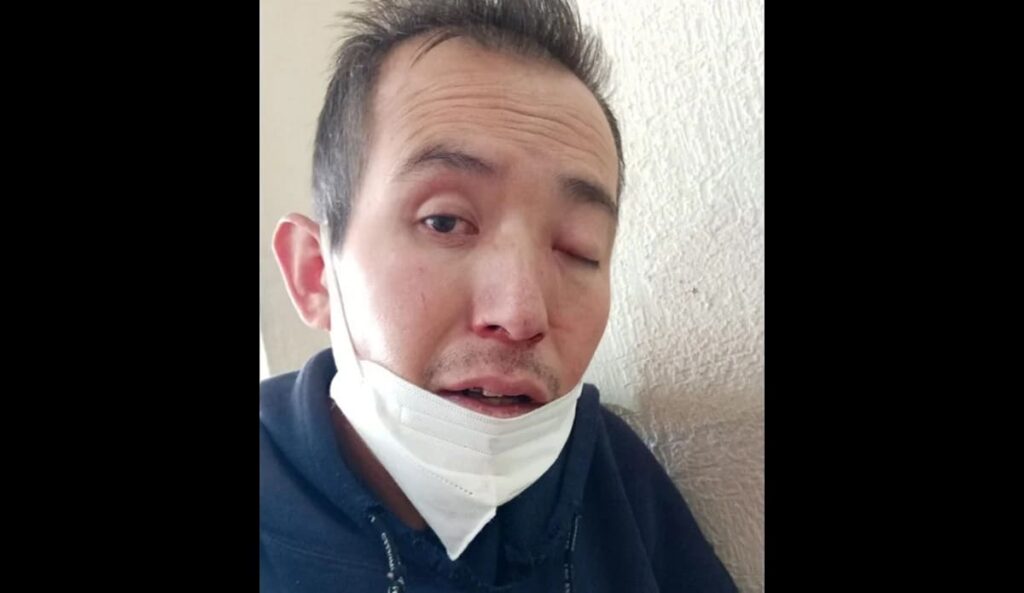 hongo negro edomex 1