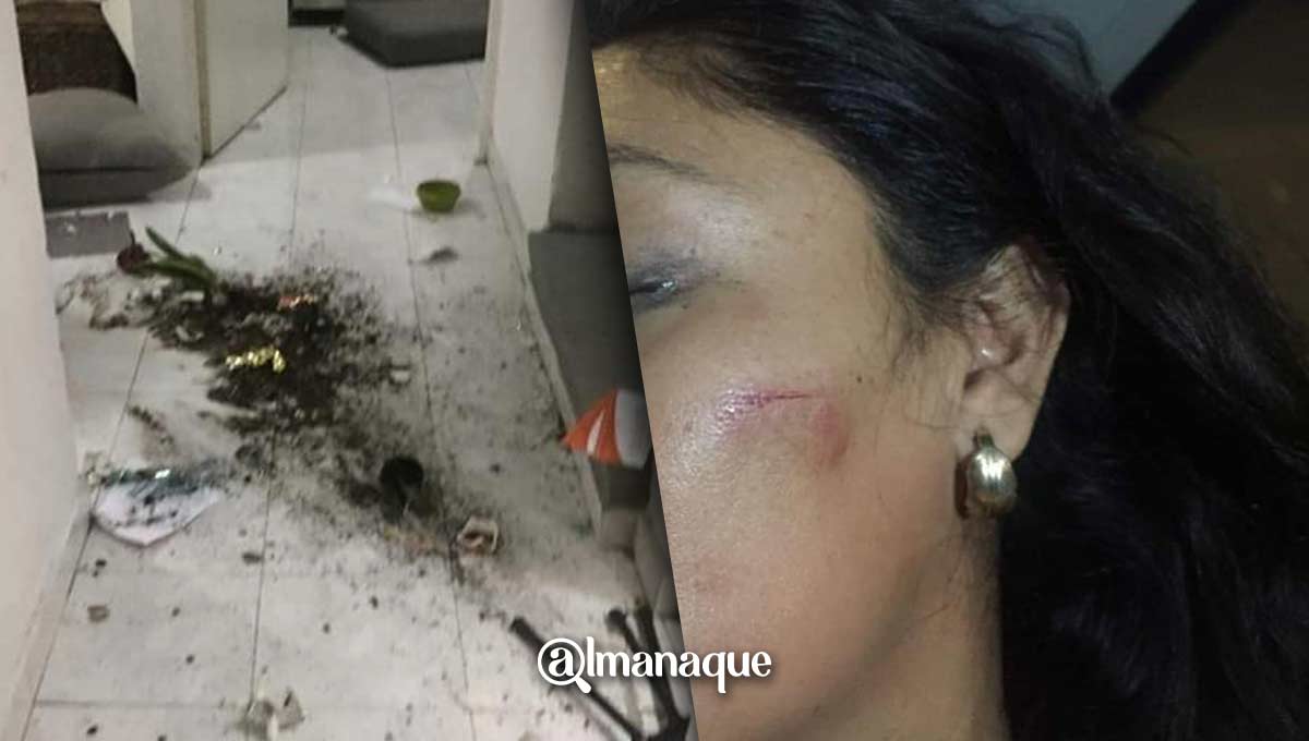 Gaby fue golpeada por el padre de sus hijos en Puebla; pide ayuda a las autoridades 2 portada Ricardo Lopez Dorantes Gaby M