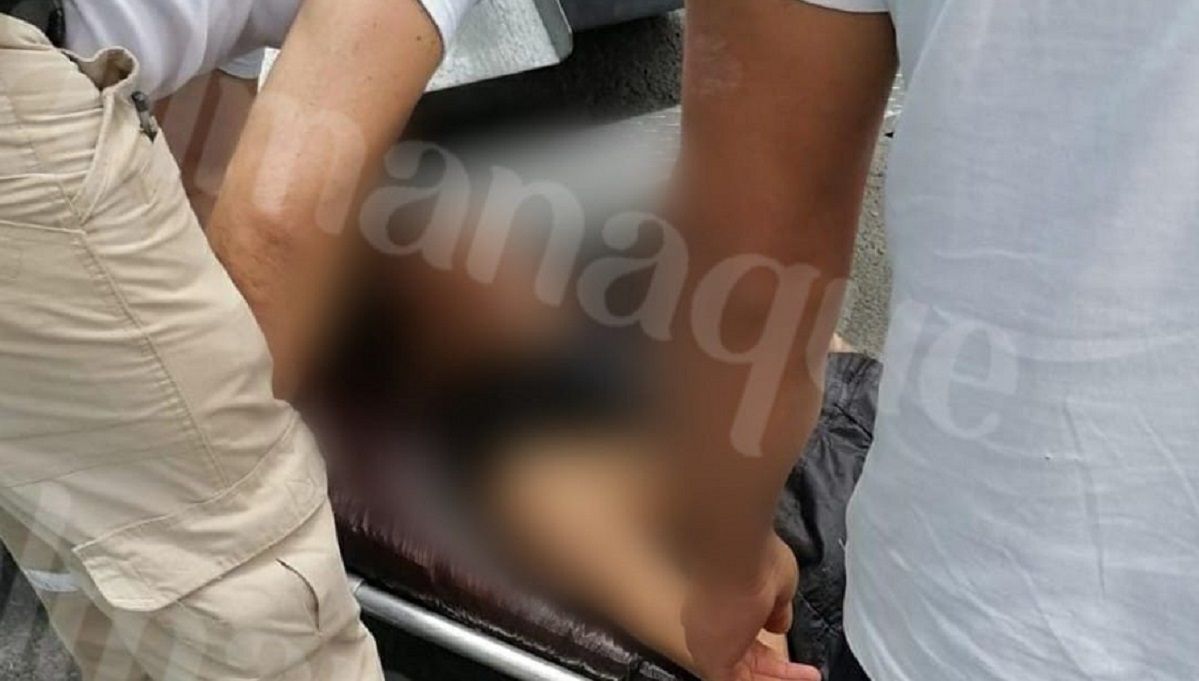 Tragafuegos se quema la cara cerca del Mercado Hidalgo 2 tragafuegos