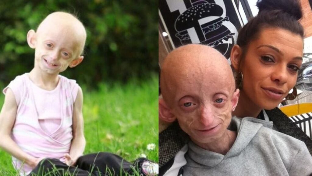 inglaterra. joven de 18 muere con cuerpo de mujer de mas de 100 anos