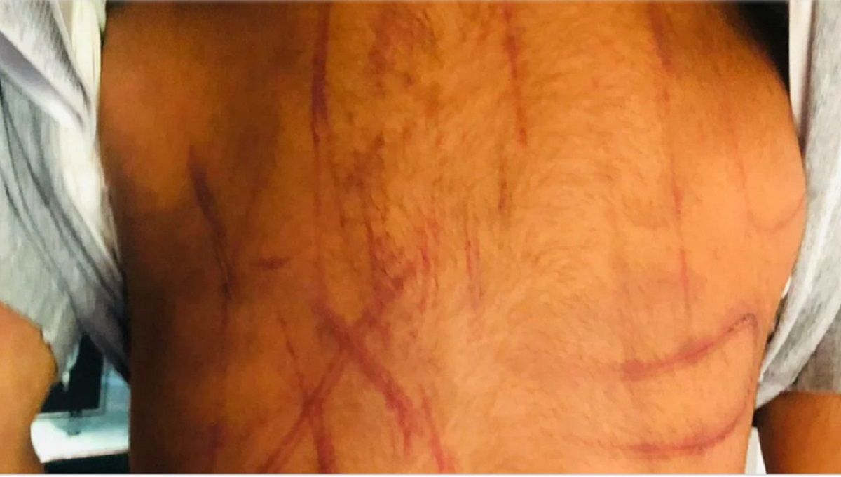 Rescatan a niño de 3 años golpeado por su madre y su pareja en Chalco 2 nino maltratado