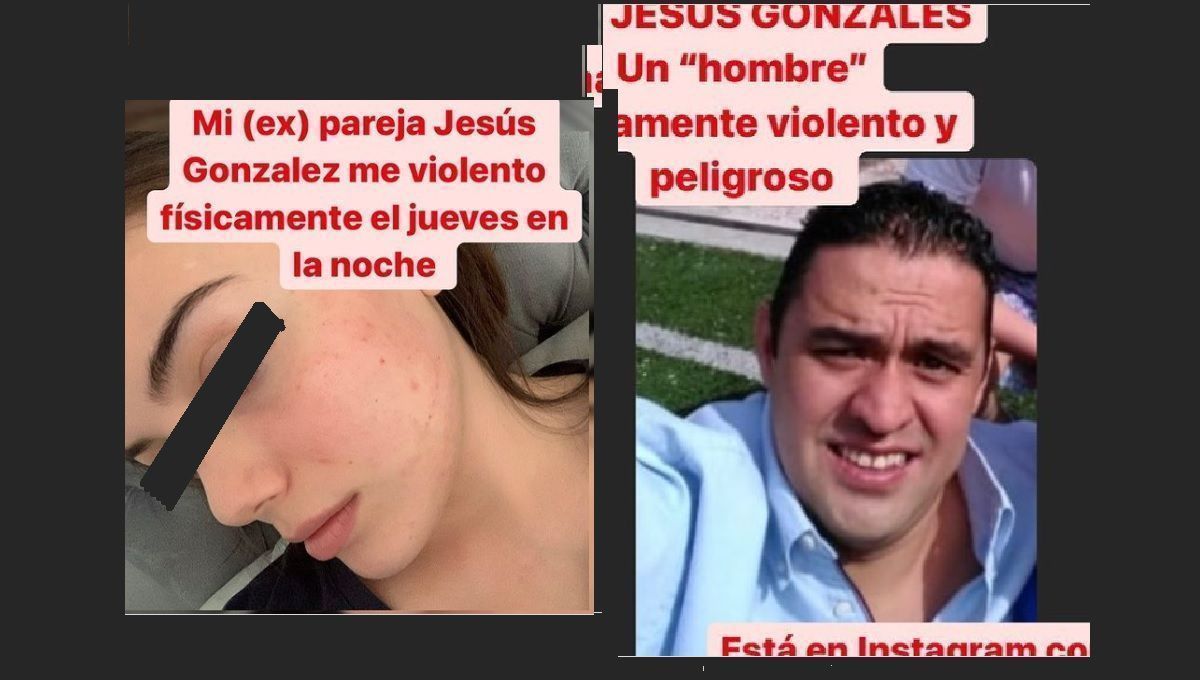 Roxanne Rodiles fue golpeada por su expareja en Puebla 1 poblana