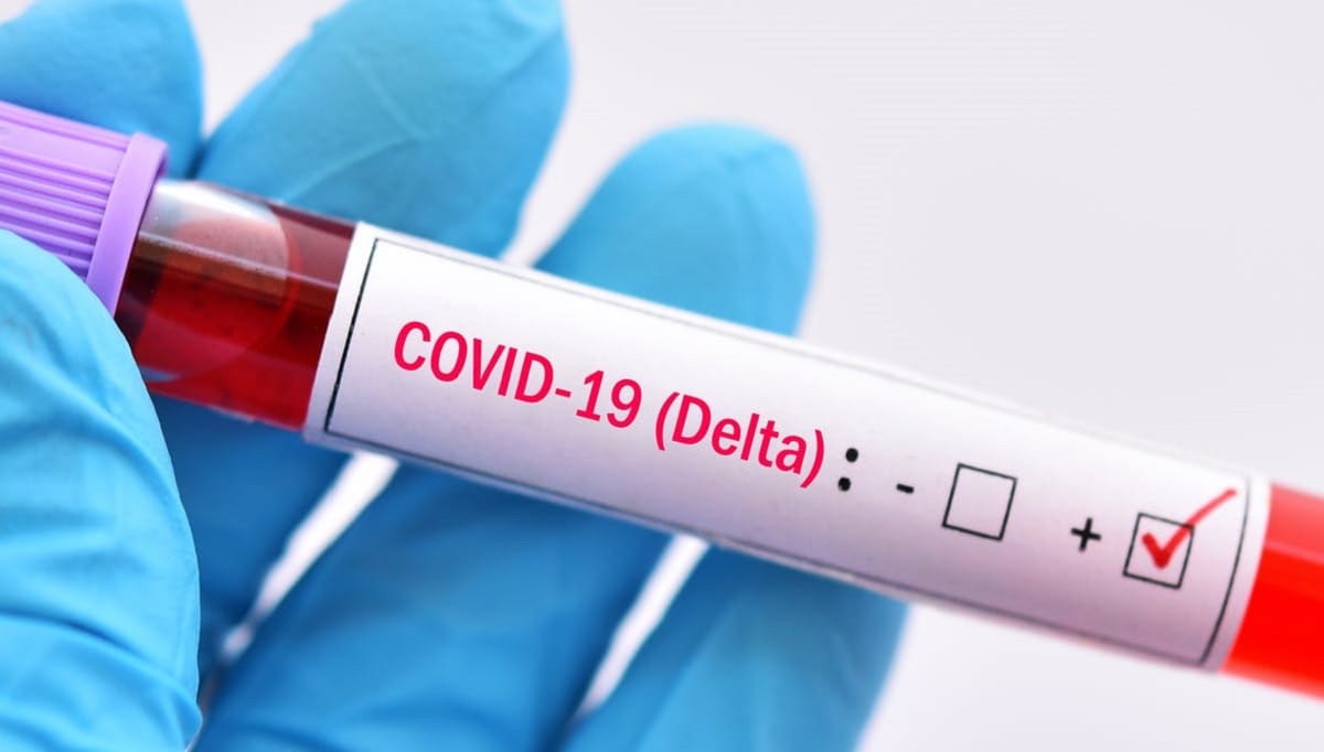 Variante Delta de COVID-19 es tan contagiosa como la varicela, advierte estudio de EU 1 variante delta 1