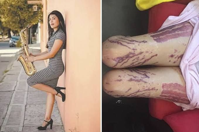 La saxofonista, María Elena Ríos exigió la intervención del presidente, Andrés Manuel López Obrador para intervenir en su caso, pues afirma que la justicia en Oaxaca no ha llegado para las mujeres. 
