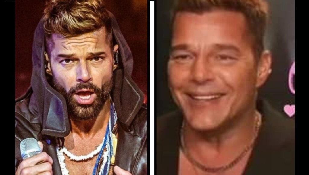 ¿Botox? Las redes reaccionan al cambio en el rostro de Ricky Martin. Foto: Milenio
