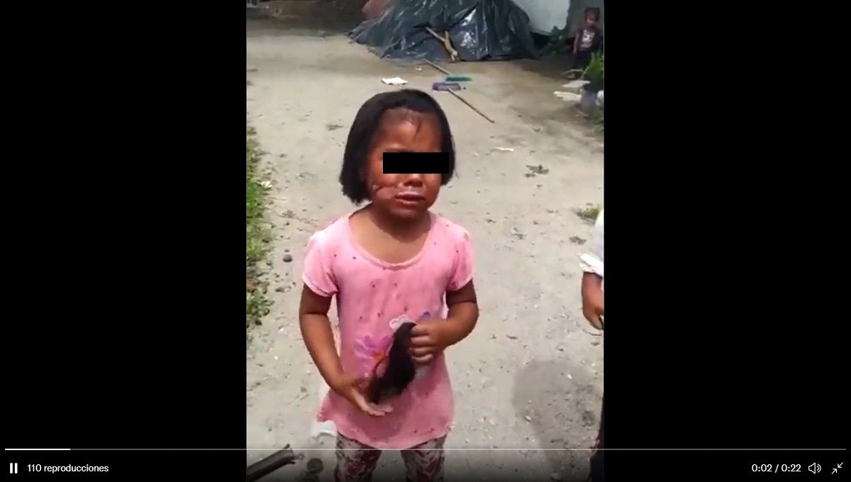 Mujer quema el rostro de su hija con Síndrome de Down y su nieta en Tecamachalco (VIDEO) 2 ninas tecamachalco