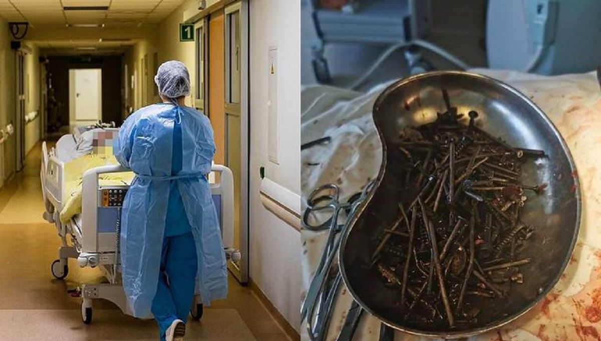 Hombre es operado de emergencia tras ingerir un kilo de clavos, tornillos, tuercas y navajas en Lituania 3 Caso Lituania