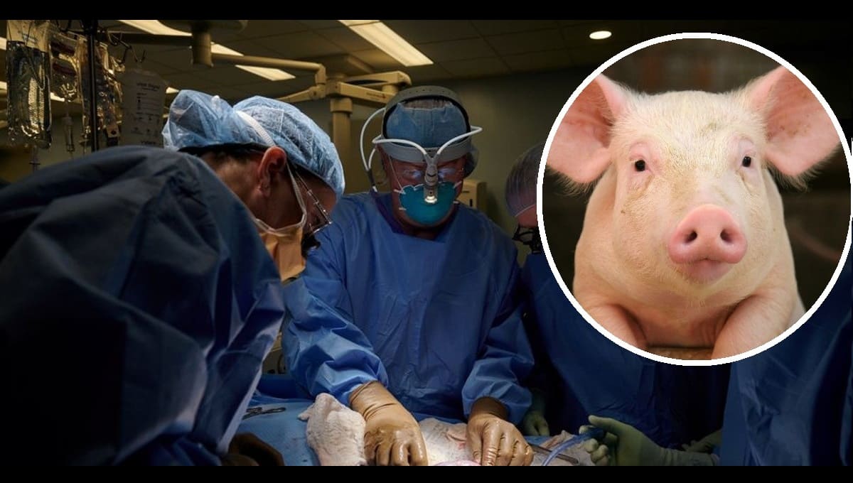 Trasplantan con éxito un riñón de cerdo a una mujer en Estados Unidos 3 trasplante de rinon de cerdo en humano01 1