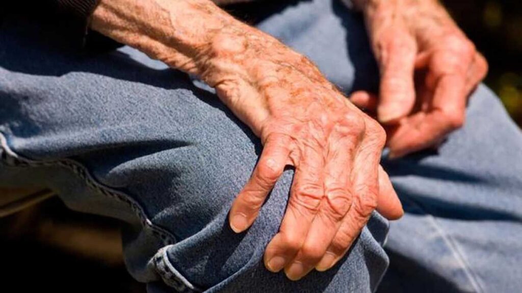 parkinson