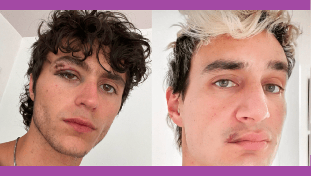 "Te voy a comer entero pinche j*to": Golpean a pareja gay en taquería de la CDMX 3 gay