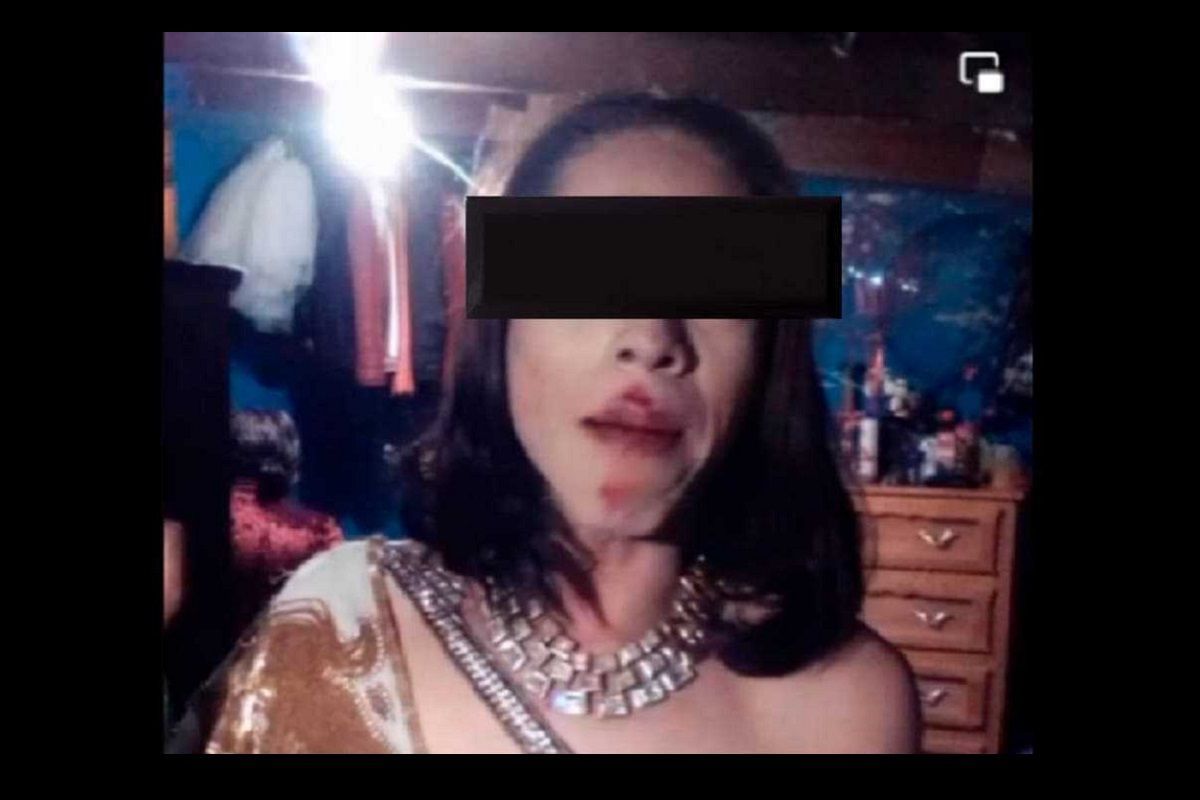 Transfobia: La activista Janeth Palacios, es brutalmente golpeada por sus vecinos en La Libertad 2 Janeth Palacios 1