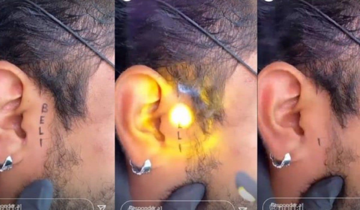 nodal se borra tatuaje 1