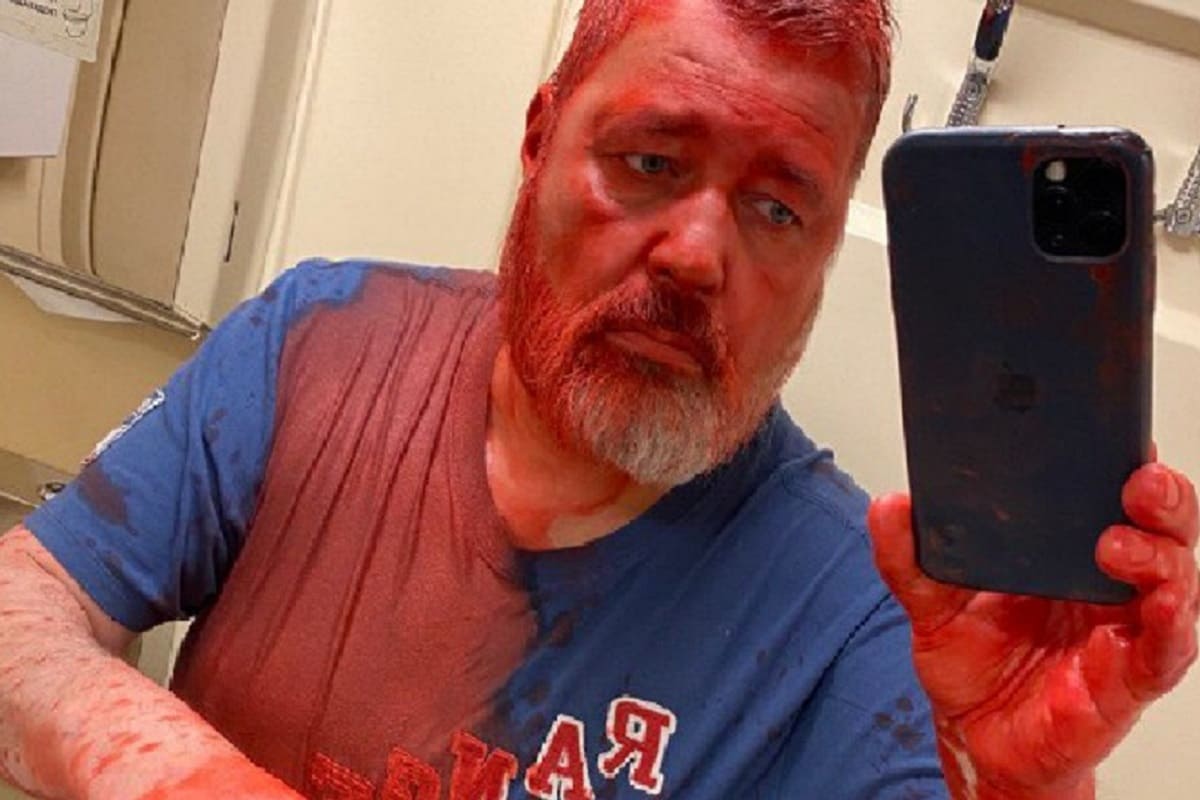 Atacan a periodista ruso premio Nobel de la Paz con pintura en la cara 6 noble ruso 1