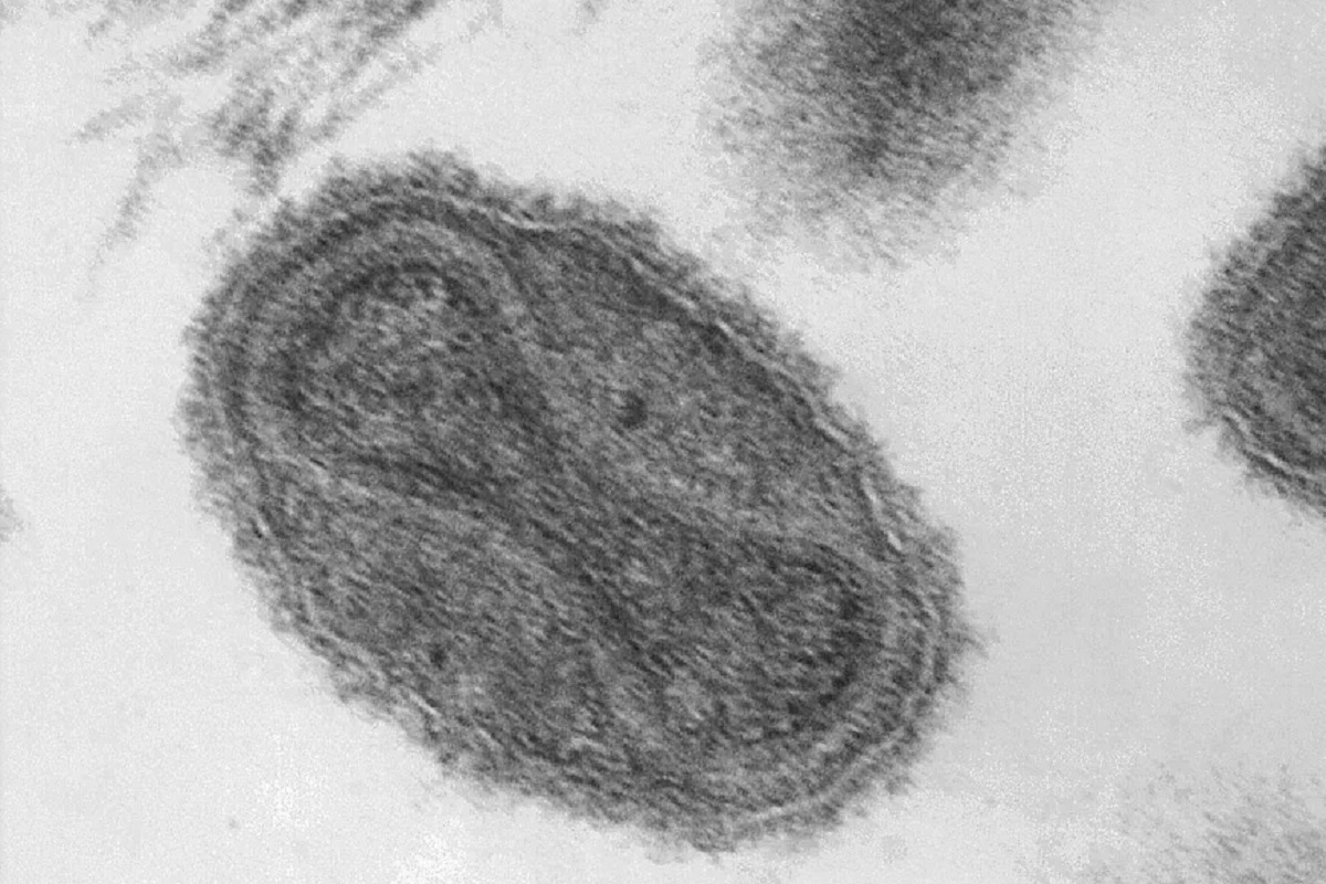 Reino Unido confirma la transmisión comunitaria de la viruela del mono 2 viruela del mono 2