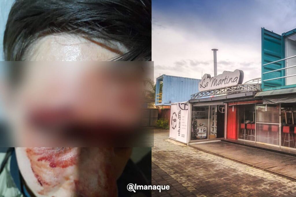 Container city joven agredido Cholula