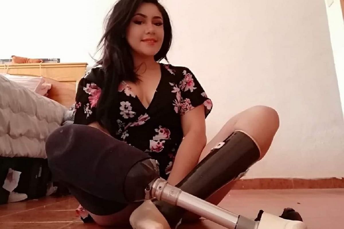 imss amputa piernas 1