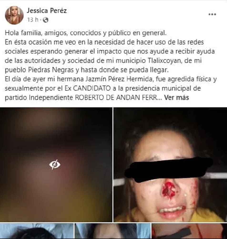 IMÁGENES FUERTES: Acusan a excandidato de Veracruz de arrancar un pedazo de nariz a una mujer 6 arrancar un pedazo de nariz a una mujer