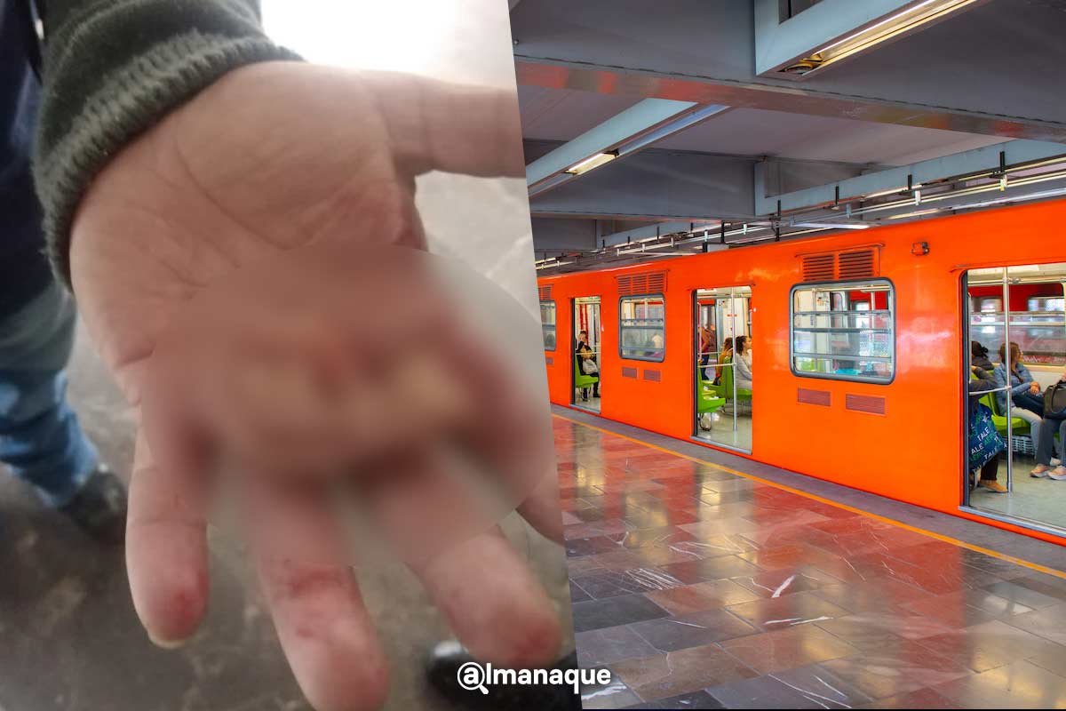 IMÁGENES FUERTES: Arrancan una oreja a un hombre durante pelea en metro de la CDMX 2 portada oreja metro