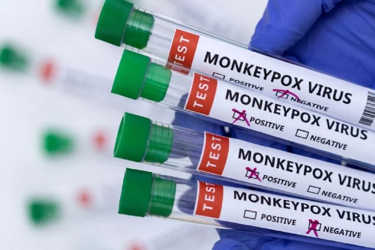 La Casa Blanca declara la viruela símica una emergencia de salud pública 2 viruela del mono