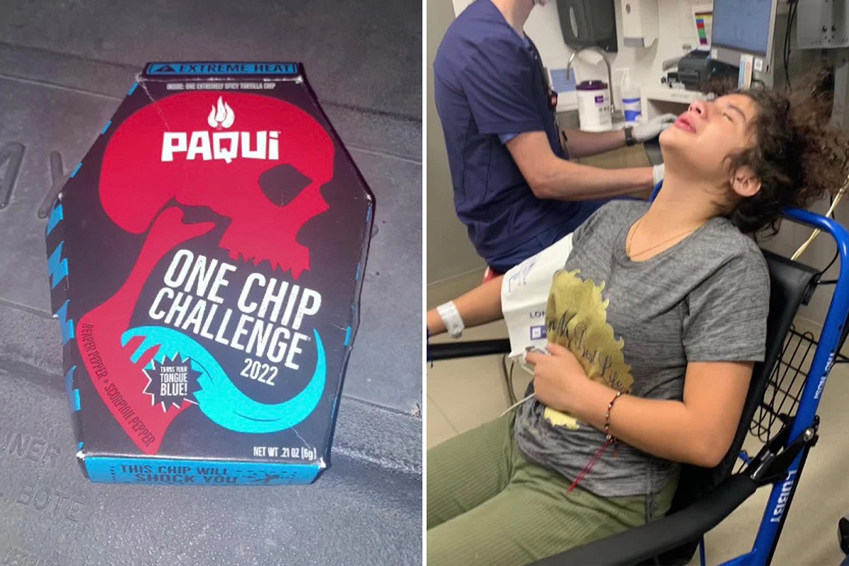 One Chip Challenge: El peligroso reto de TikTok que ha enviado a jóvenes al hospital 2 one chip challeneg1
