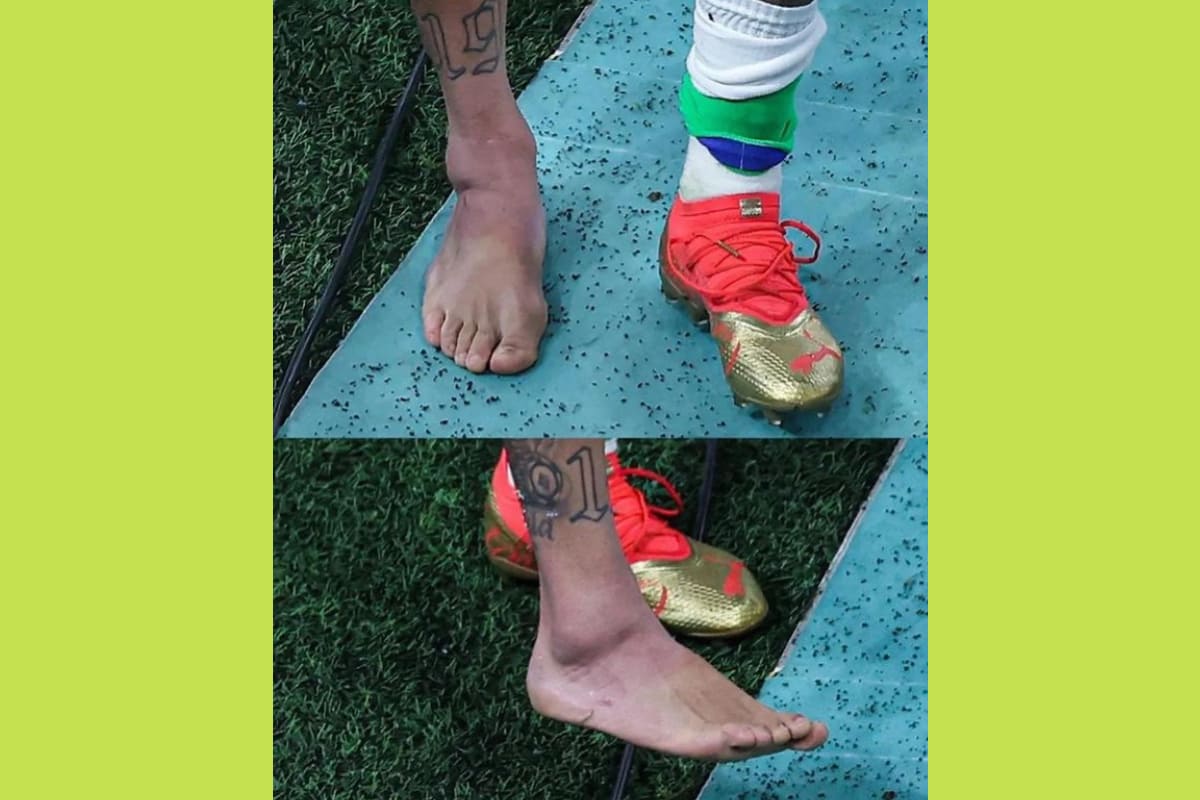 Así quedo el tobillo de Neymar