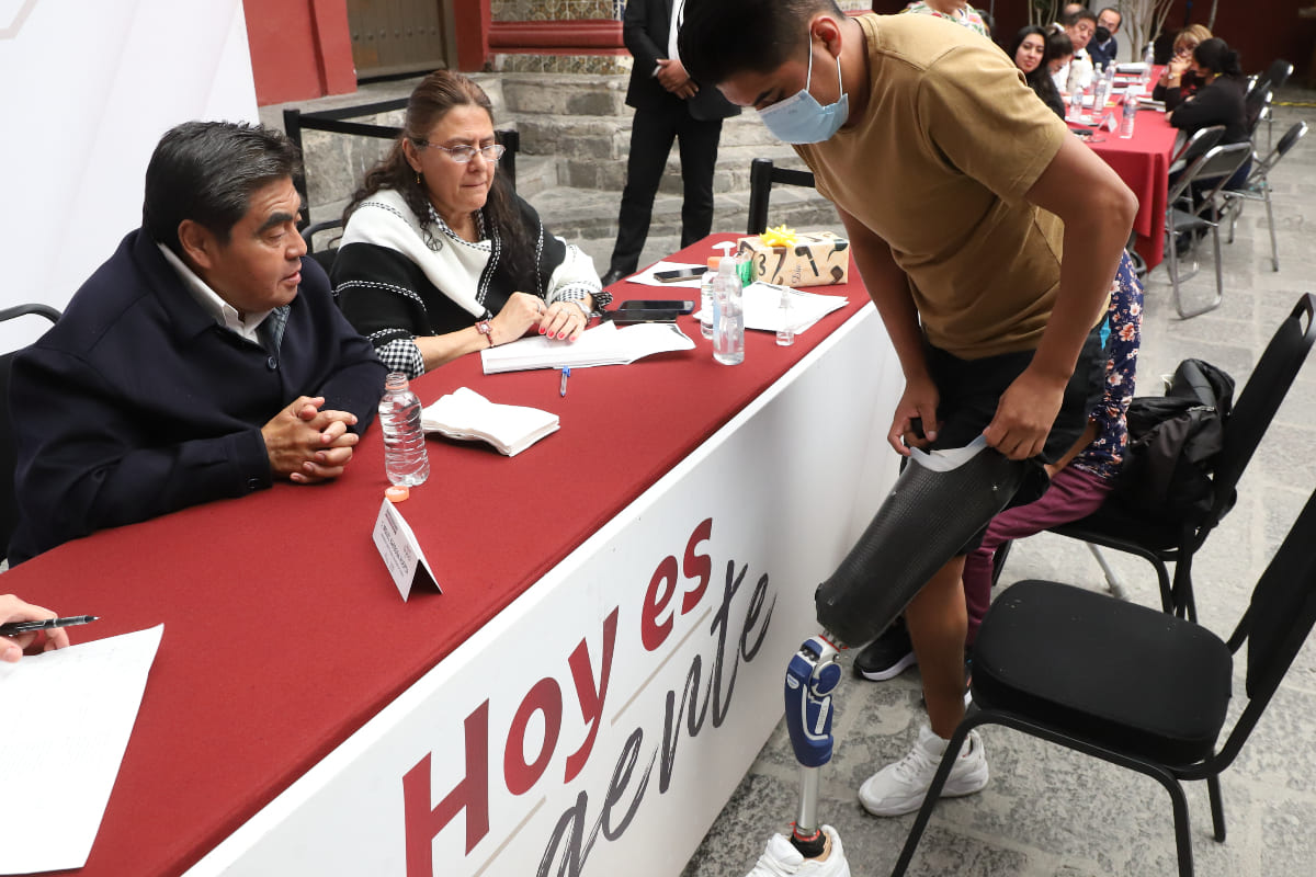 beneficiario protesis de pierna 1