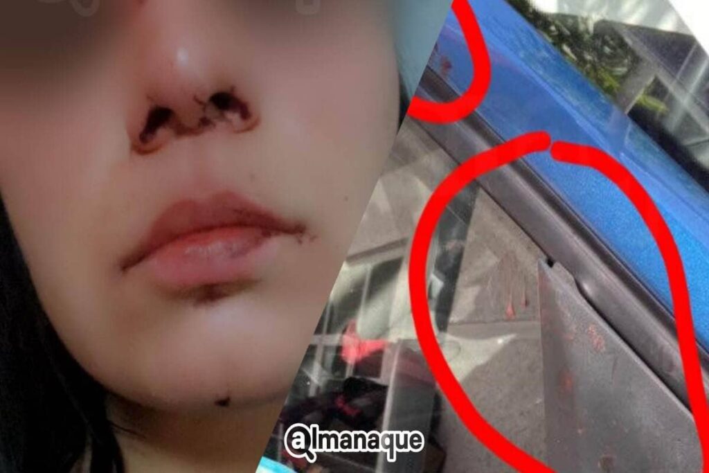 Sujetos golpean violentamente a pareja por percance vial en Puebla