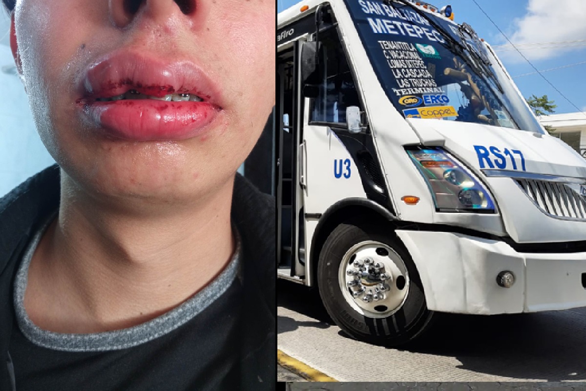 Agreden a joven para asaltarlo en la ruta 17 a la altura del Alpha 3 en Puebla 2 asalto ruta rs17