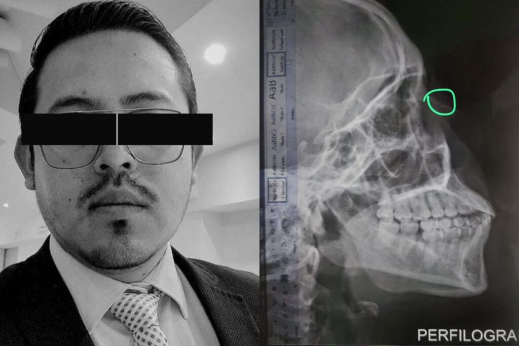 Poblana denuncia que pareja la violentaba