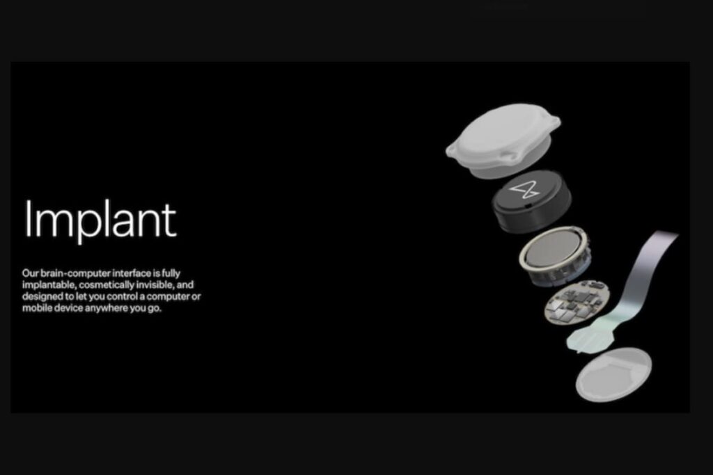 chip cerebral elon musk 2