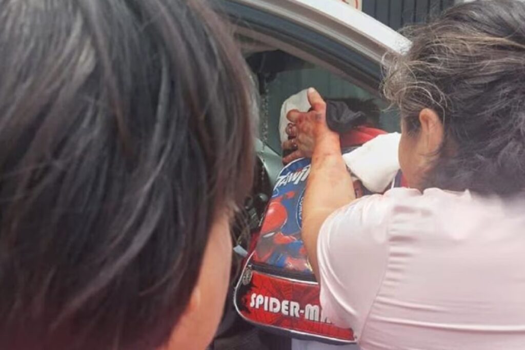 pitbull ataca a nino en Oaxaca