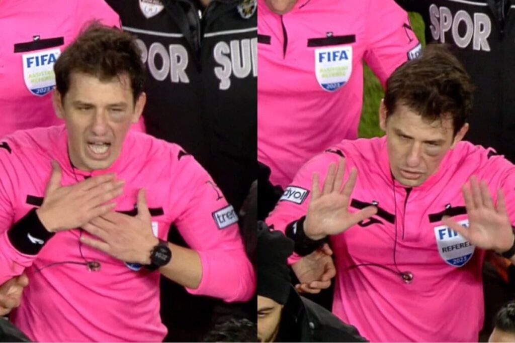 árbitro golpeado en Turquía
