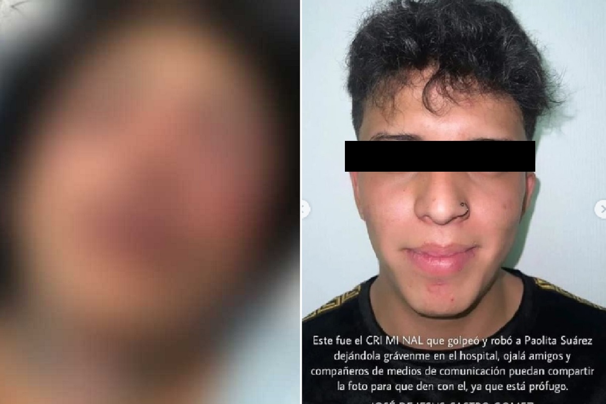 Paola Suárez hospitalizada tras golpiza que le dio su novio; ayer le pidió matrimonio 1 paola suarez hospitalizada