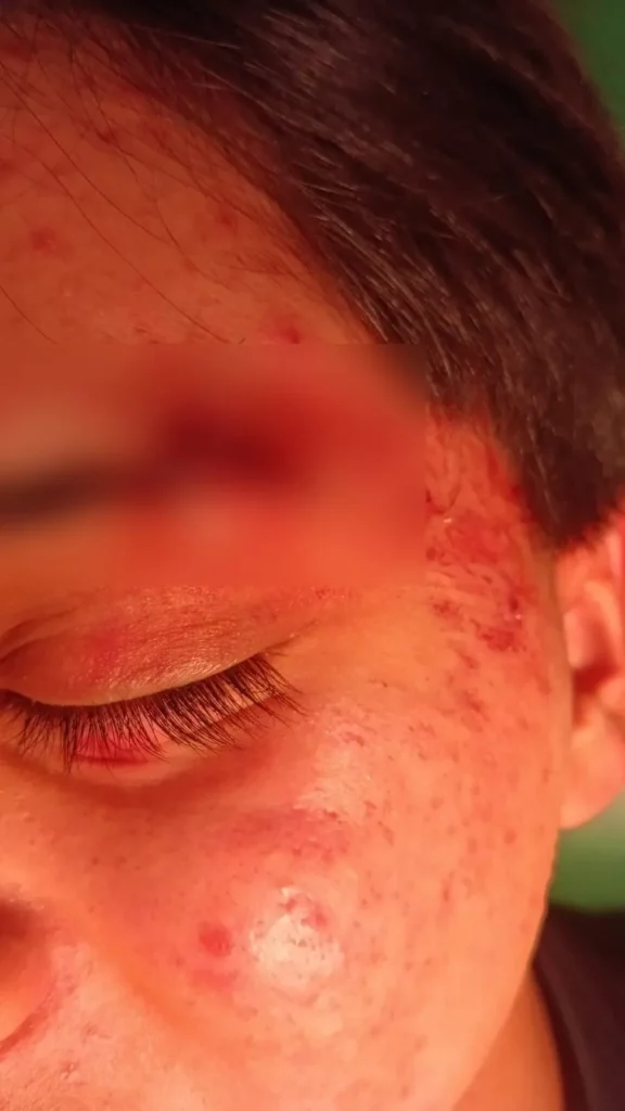 Alumnos del CENHCH golpean brutalmente a compañero y lo amenazan de muerte; SEP investiga 2 alumnos del cenhch amenazan de muerte a compañero