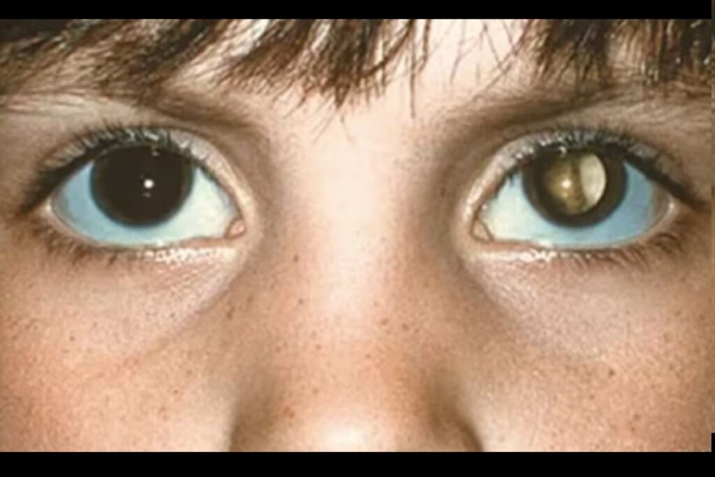 Madre británica detecta cáncer en su bebé gracias al flash